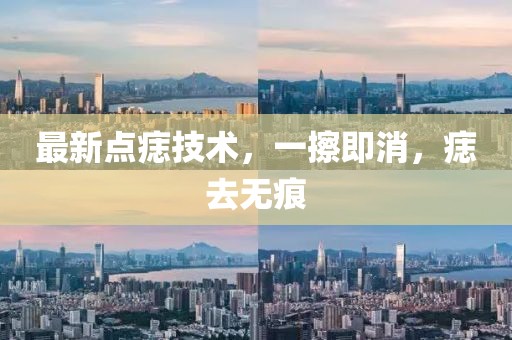 最新點痣技術(shù)，一擦即消，痣去無痕